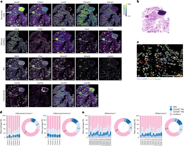 Figure 3 | Compartmentalized IM and recMac populations organize chemokine landscapes in lung adenocarcinoma