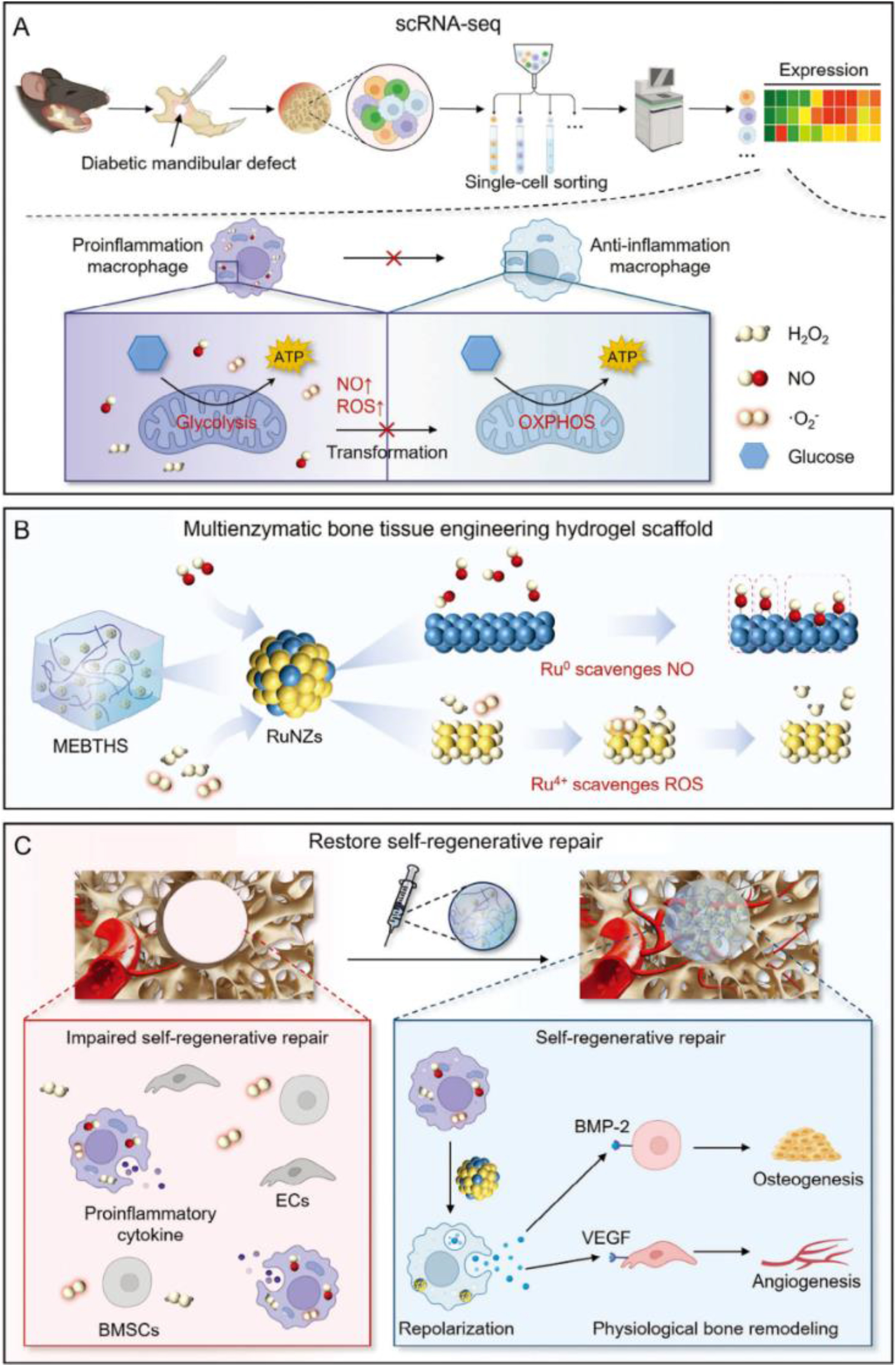 Figure 14 | MEBTHS design for diabetic mandibular defect